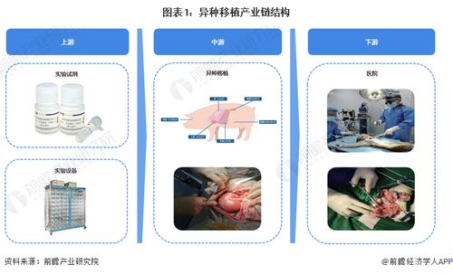 重大里程碑 科学家首次将猪肝移植到人体，成功过滤血液72小时，计算机软硬件技术开发的关键作用